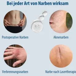 Evolsin Narben Gel, 20 g