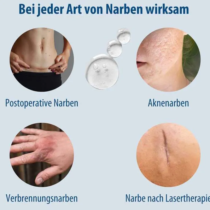 Evolsin Narben Gel, 20 g