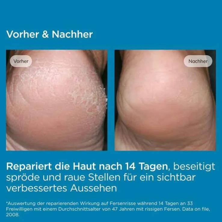 ISDIN Ureadin Podos Gel-Oil, 75 ml