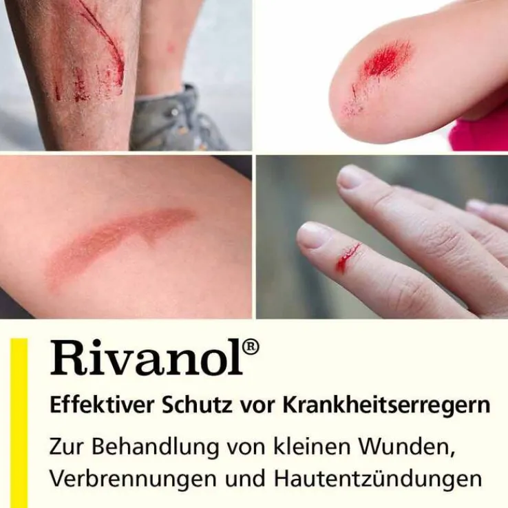Rivanol 1,0 g Pulver, 5 St